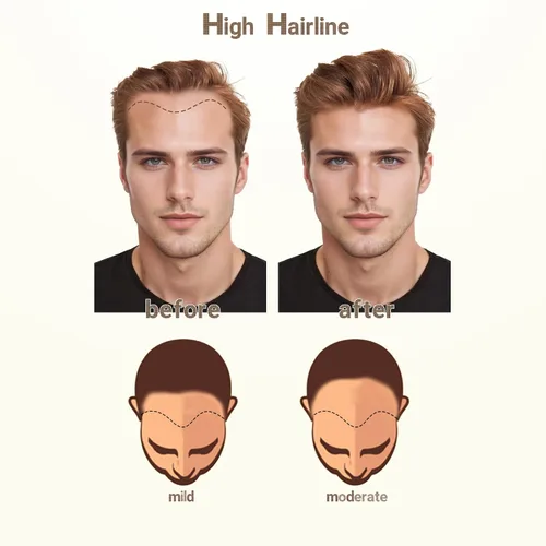 Vista 7 de Extensión frontal de cabello rubio claro para hombres, extensión de cabello lacio con pérdida de línea de cabello humano con cinta adhesiva
