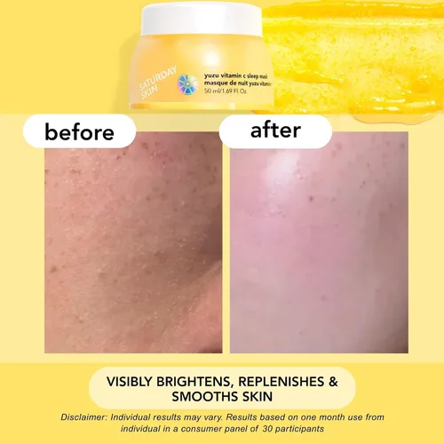 Vista 5 de Saturday Skin Yuzu - Máscara de vitamina C para dormir durante la noche, regenerista, retinol, crema hidratante facial ultra rica, suaviza la piel