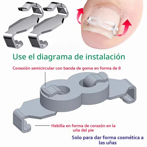 Vista 2 de Kit de corrección de uñas encarnadas Professional Nail Care Tools, Correction Clips and Adhesive Pads, Four Correction Clips, Correct Two Toenails