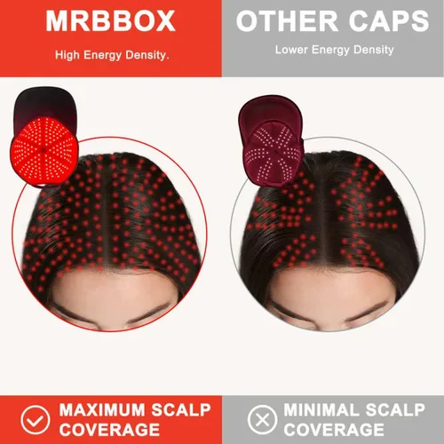 Vista 3 de Gorra de crecimiento del cabello con luz roja, 528 emisores de luz total, terapia de luz roja para el cabello, ajuste ajustable, sesiones en casa