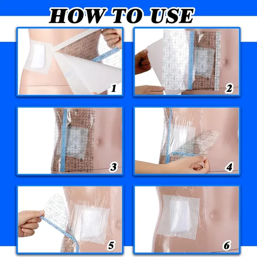 Vista 4 de Nuanchu 25 piezas de cubierta de catéter de diálisis de 7.87 x 7.87 pulgadas, cubierta de ducha peritoneal, accesorios de diálisis peritoneal