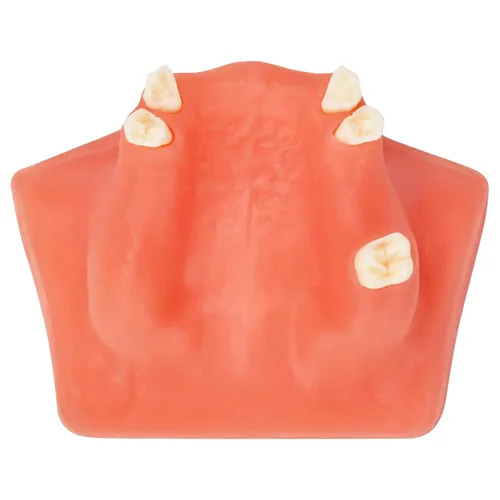 Vista 8 de Ultrassist Entrenamiento de implantes dentales Modelo edéntulo maxilar, maxilar simplificado con tejido suave, gran diente de entrenamiento