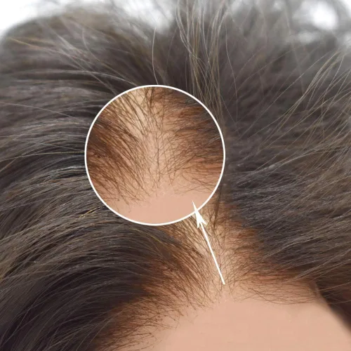 Vista 8 de Tupé de pelo para hombres Cabello humano para hombre Hairpieces y tupés Durable Fine Monofilament Mens Hair System Lace Front Mens Toupee Mens Hair