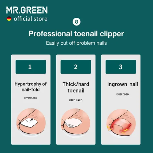 Vista 3 de MR.GREEN Cortaúñas para uñas de los pies, antisalpicaduras, profesionales, encarnadas, gruesas, duras, herramientas de pedicura, juegos de manicura