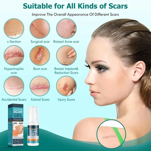 Vista 3 de Gowgaw Gel para cicatrices, crema para cicatrices, gel avanzado para cicatrices quirúrgicas, cara, cuerpo, pierna, quemaduras, acné, cesárea