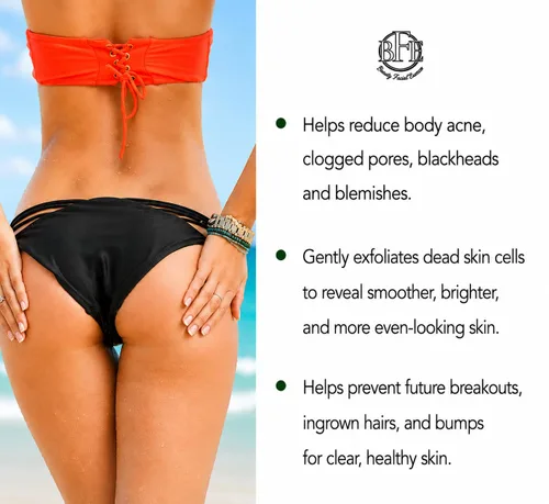 Vista 2 de Crema para el tratamiento del acné en los glúteos, brotes claros, espinillas, manchas oscuras y pelos encarnados para glúteos y muslos, suaviza