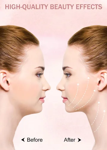 Vista 3 de Yeahka Máscara de elevación de línea V, correa de adelgazamiento facial, reductor de barbilla doble, cinturón de elevación facial en forma de V