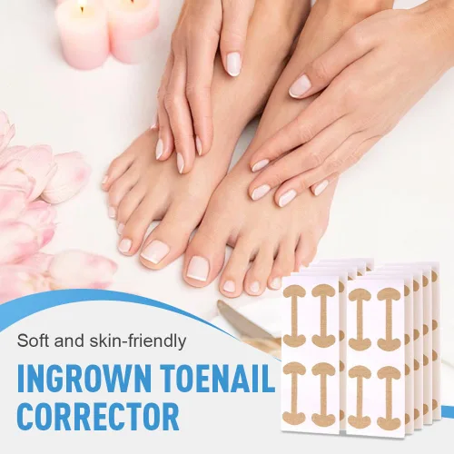 Vista 3 de Kit de tratamiento de uñas encarnadas, tiras correctoras transpirables y herramientas de pedicura sin dolor, parche corrector de uñas profesional