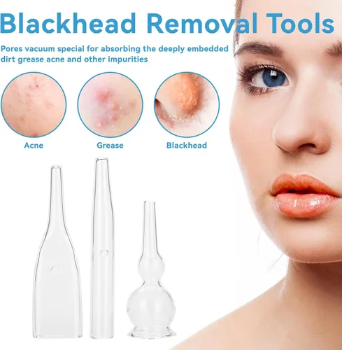 Vista 2 de Kit de tubo de vidrio al vacío, 3 piezas, eliminación de puntos negros, aspirador de poros de succión facial para limpiador facial, máquina