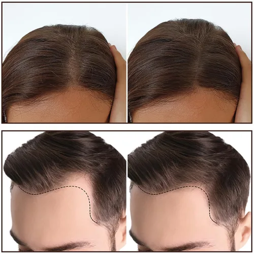 Vista 2 de Boobeen Barra de polvo de línea capilar para cabello fino, retoque y corrector de raíces para pérdida de cabello