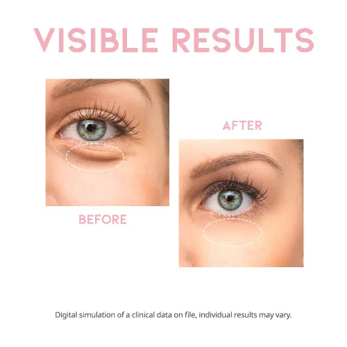 Vista 6 de Suero de crema de ojos con cafeína para ojeras, hinchazón y bolsas en los ojos, tratamiento reafirmante para hombres y mujeres con colágeno