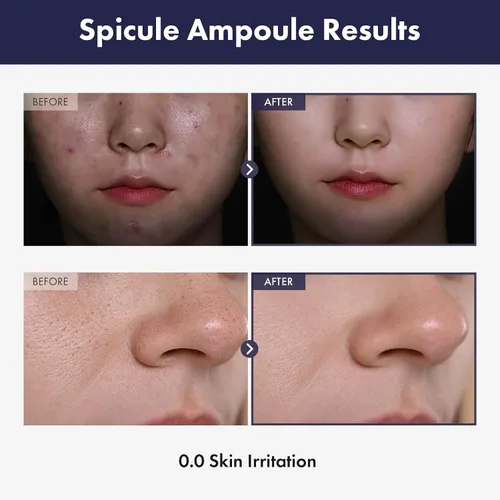 Vista 2 de TOSOWOONG Ampolla real Spicule con 30,000 inyecciones, niacinamida, pantenol, suero líquido potenciador de la piel, minimizador de poros