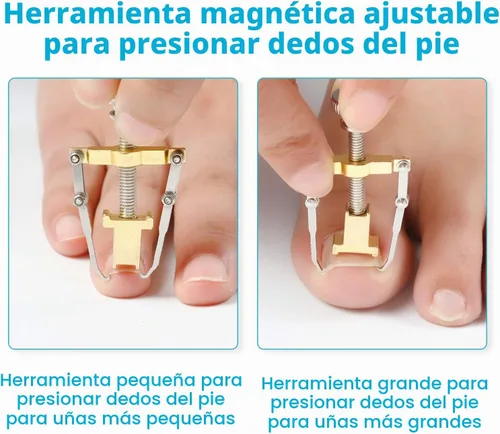 Vista 4 de 2 piezas encarnadas levantador de uñas encarnadas herramienta de uñas encarnadas abrazadera del dedo del pie de acero inoxidable herramienta