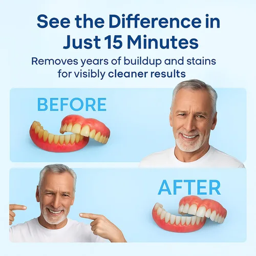 Vista 5 de iSonic Limpiador ultrasónico de dentadura/alineador/retenedor para todos los aparatos dentales y de la apnea del sueño (F3900)