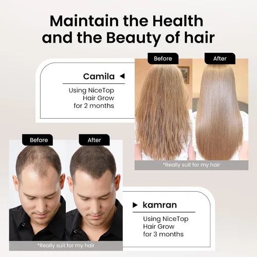 Vista 4 de Suplemento para el crecimiento del cabello, apoyo para el cuidado del cabello para fortaleza, crecimiento de espesor, con biotina vitamina A, C, E