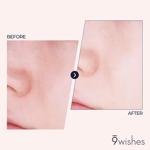 Vista 3 de 9 Wishes Limpiador espumoso de arroz (5.07 onzas líquidas) - Limpiador facial suave para control de sebo y eliminación de puntos negros con agua