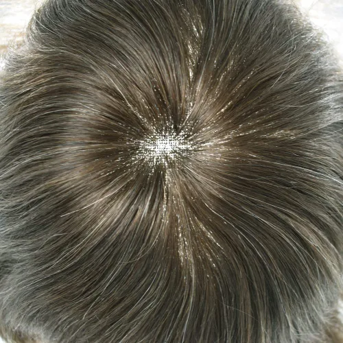 Vista 58 de Mens Toupee Natural Hairline Swiss Lace Toupee Remy Human Hair Piece For Men Bleached Knots Mens Hair Replacement System Toupee 6X8#1 Jet Black 100%