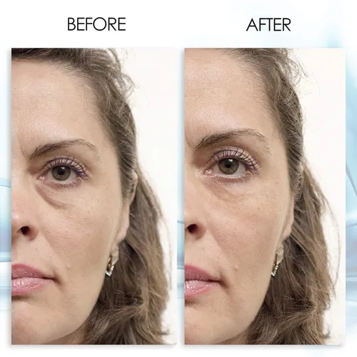 Vista 2 de Gel para ojos Puffy Eye Resultados instantáneos – Gel de ojos de reducción naturalmente rápida, elimina arrugas, hinchazón y bolsas – Gel hidratante