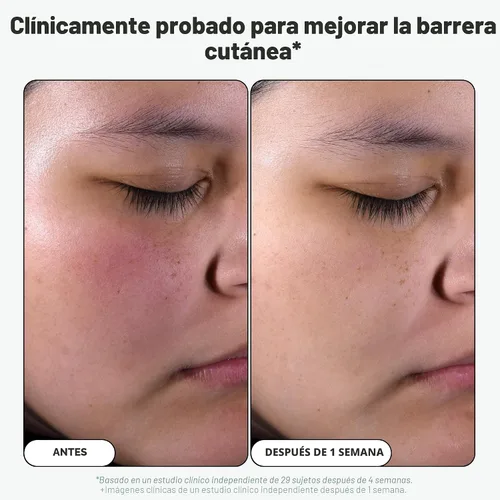 Vista 6 de Paula's Choice Skin Perfecting - Exfoliante líquido de ácido salicílico BHA al 2 %