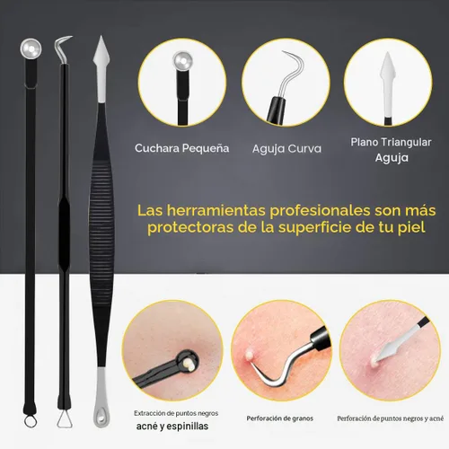 Vista 3 de Boxoyx - Kit de herramientas para reventar espinillas, kit de 10 piezas para eliminar puntos negros, kit extractor de comedones con caja