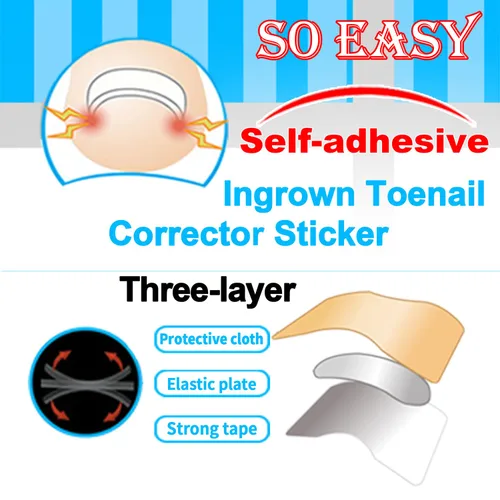 Vista 3 de Juego profesional de herramientas para uñas encarnadas con tiras transpirables para uñas encarnadas, parche corrector de uñas curvas, lima