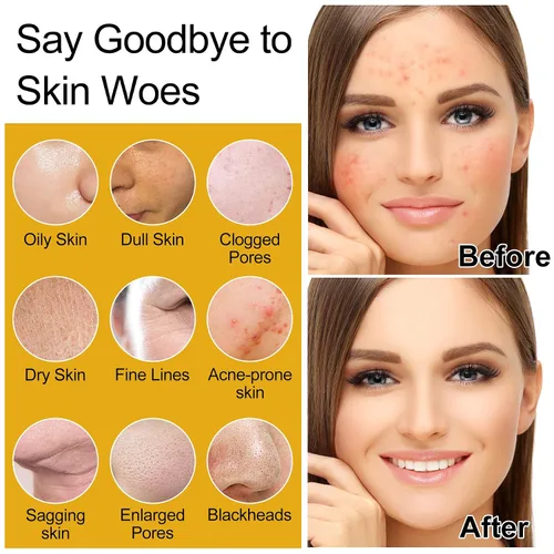 Vista 2 de Juego de cuidado de la piel, para mujeres y adolescentes, cuidado de la piel Glass con extracto de arroz coreano, hidratante, reparador iluminador
