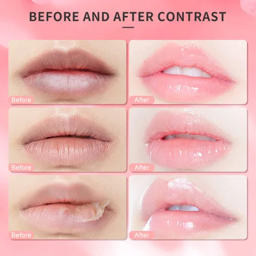 Vista 4 de Exfoliante de labios, exfoliante de labios, hidratante DR.YIMAN Sugar Lip Scrub, exfoliante labial para labios secos y agrietados