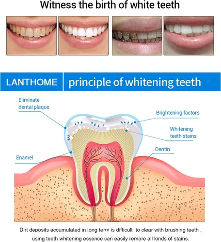 Vista 4 de 3 bolígrafos blanqueadores de dientes, esencia blanqueadora de dientes, gel blanqueador de dientes, removedor de manchas de dientes para blanquear