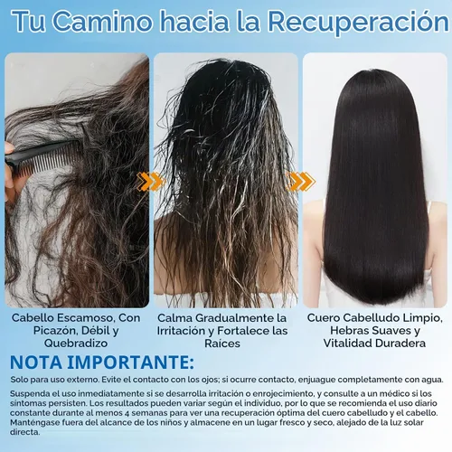 Vista 6 de Champú para el control de la caspa, sin sulfatos ni parabenos