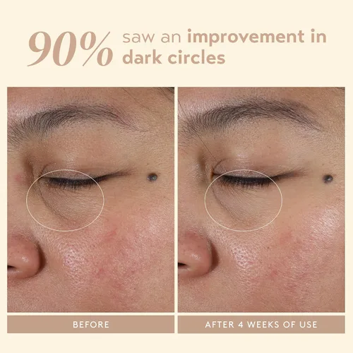 Vista 5 de SHANI DARDEN Crema intensiva renovadora de ojos, crema hidratante debajo de los ojos para ojeras, líneas finas, arrugas y patas de gallo