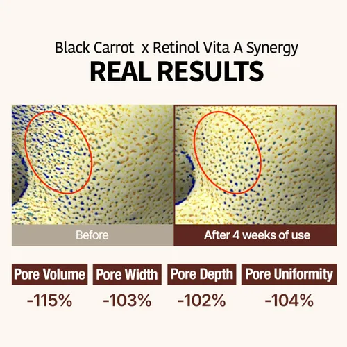 Vista 3 de GOODAL Black Carrot VITA-A - Ampolla de retinol de 1.0 fl oz, suero facial de hidratación para piel brillante, suero ligero, cuidado de la piel