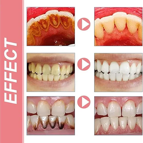 Vista 4 de Cophksu Sp10 Pasta de dientes probiótica, Sp10 Pasta de dientes probiótica blanqueamiento, Sp 10, Sp10 Pasta De Dientes (2 unidades)