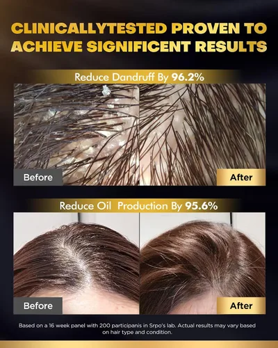 Vista 5 de Juego de champú y acondicionador de biotina para crecimiento del cabello con infusión de tripéptido, tratamiento hidratante voluminizador