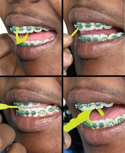 Vista 8 de Braces Cepillo de dientes recargable con 4 cabezales Bonus 2 AFTERCARE