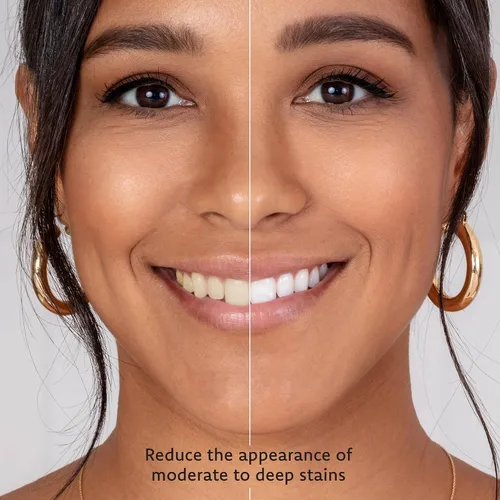 Vista 3 de Jeringas blanqueadoras de dientes para eliminación de manchas profundas: gel blanqueador de dientes de fuerza profesional para bandejas con 35%