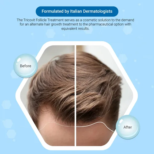 Vista 2 de Tricovit Champú para el crecimiento del cabello para mujeres y hombres, tratamiento del cuero cabelludo para adelgazamiento del cabello, regula
