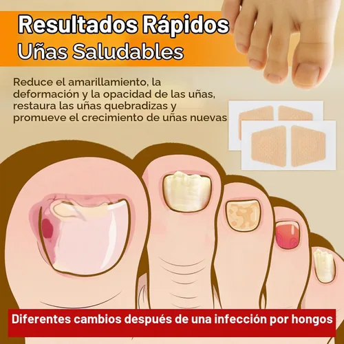 Vista 7 de 100 parches de uñas, tiras de aspecto de uñas de 8 horas durante la noche, extra adhesivas, calcomanías de lactancia diaria