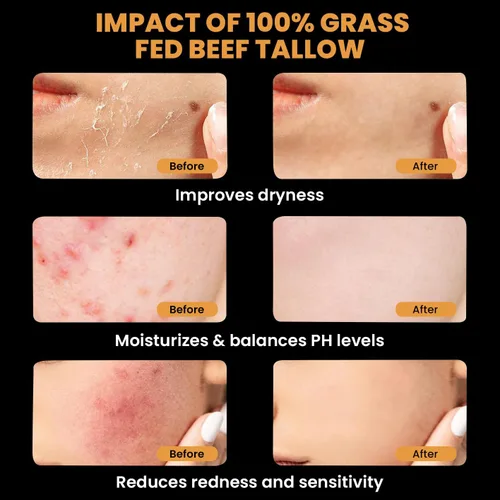 Vista 3 de MONIER Bálsamo de sebo y miel para rostro, sebo de res para la piel, humectante con sebo de res 100% orgánico de ganado alimentado con pasto y miel