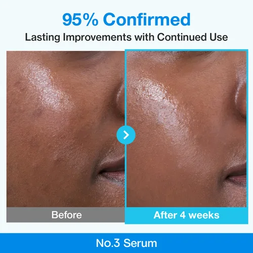 Vista 4 de numbuzin Suero de retinol No.3 Suero de refinación de poros azul bio-retinol Retinol principiante, apriete, reafirmante, BHA, niacinamida