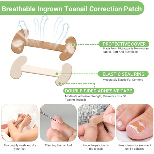 Vista 6 de Juego de corrector de uñas encarnadas con tiras correctoras, kit de herramientas profesionales para uñas de los pies, incluye tiras transpirables