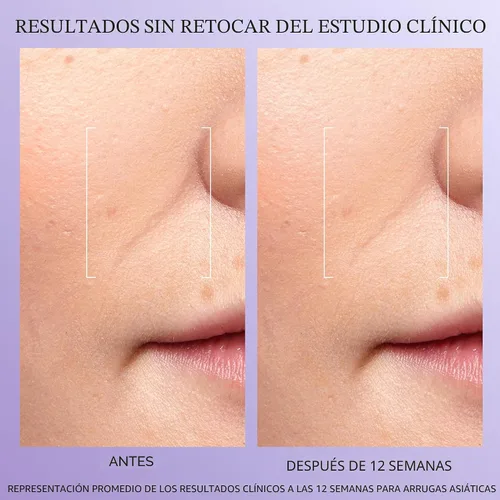 Vista 3 de Lancôme Rénergie H.C.F. Triple Serum - Suero de ácido hialurónico para corrección visible de signos antienvejecimiento y manchas oscuras - Con