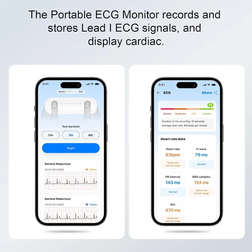Vista 4 de Monitor portátil de ECG Registre y almacene señales de ECG de una sola derivación Monitorear y mostrar la frecuencia cardíaca para uso