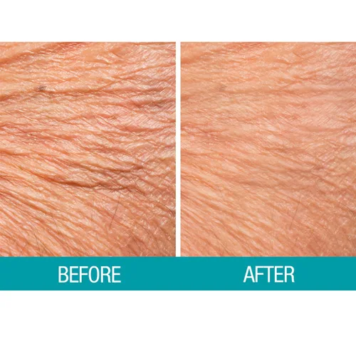 Vista 4 de Dermactin Crema reafirmante para la piel crepé 2.5 oz.