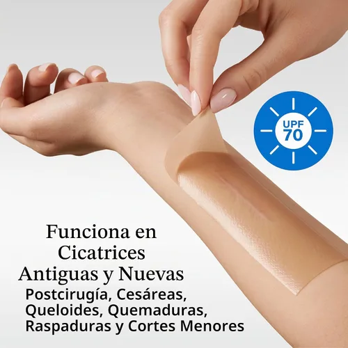 Vista 7 de Nuvadermis Paquete de cuidado de cicatrices - Gel avanzado para cicatrices y cinta de silicona para cicatrices