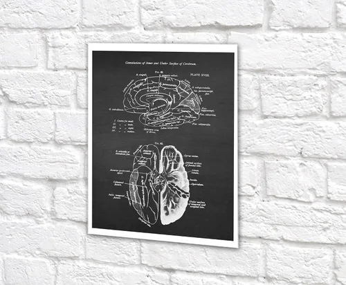 Vista 8 de Gnosis Picture Archive Neuroscience Art set de 6 impresiones sin marco de anatomía del cerebro humano