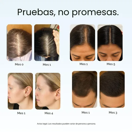 Vista 3 de Growplex Revive Champú fortalecedor para cabello – Con Biotina, Cafeína, Romero y Niacinamida – Apoya un cabello más grueso y con más cuerpo – Sin