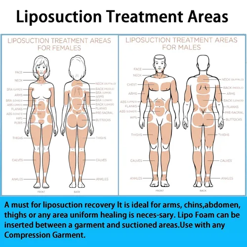 Vista 5 de Paquete de 3 almohadillas de espuma Lipo para uso postoperatorio para uso con cirugía posliposucción, aplanamiento de compresión abdominal