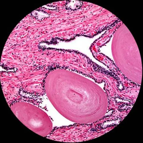 Vista 7 de AmScope Microscopio LED compuesto biológico T360B-M 40X-2000X + cámara digital de 1.3MP