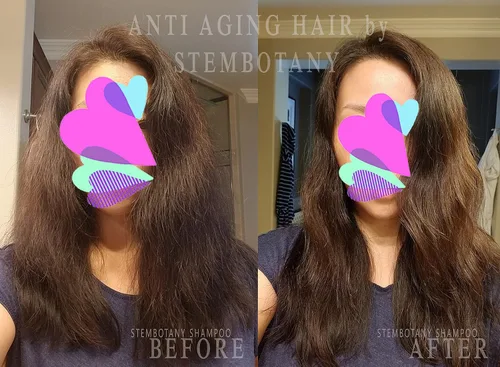 Vista 3 de Champú de células madre para cabello fino y de aspecto adelgazante, fórmula natural súper brillante, segura para el color, con cafeína, péptidos