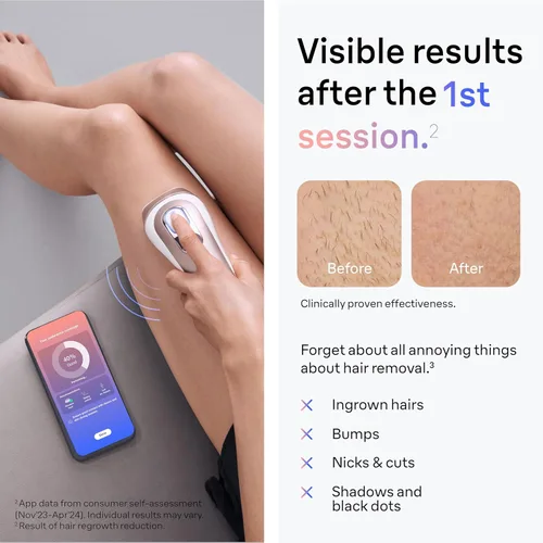 Vista 4 de Braun Smart IPL, el mejor dispositivo de depilación de Vogue, Skin i·Expert Pro 7: depilación láser en casa, reducción permanente y visible